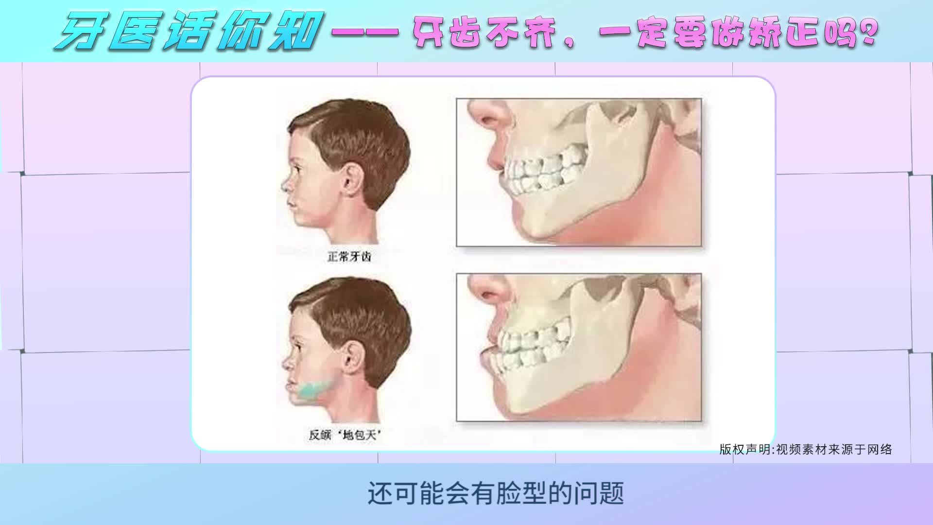 牙齿不整齐，要不要做矫正？正畸专家道出详细解答！